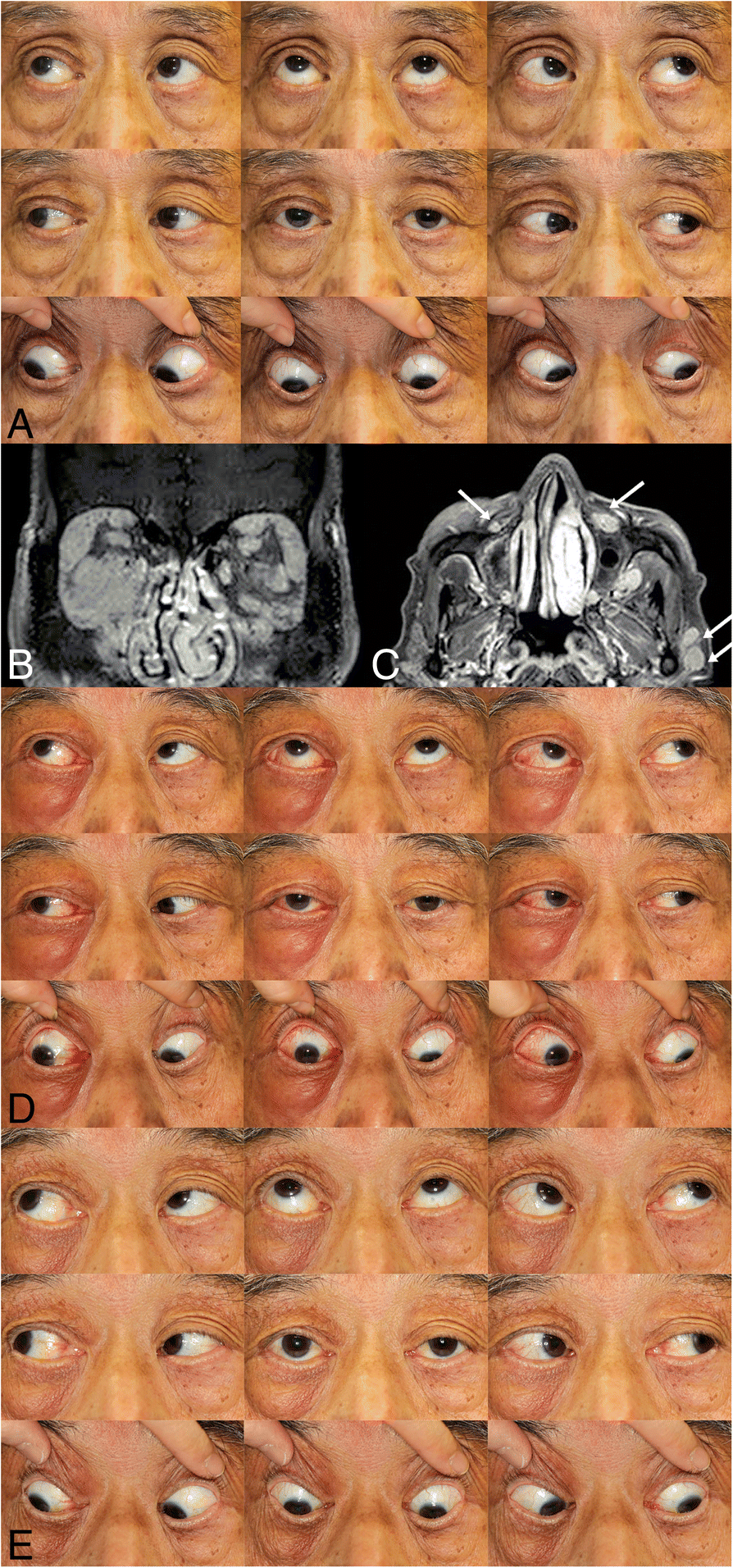 Fig. 4