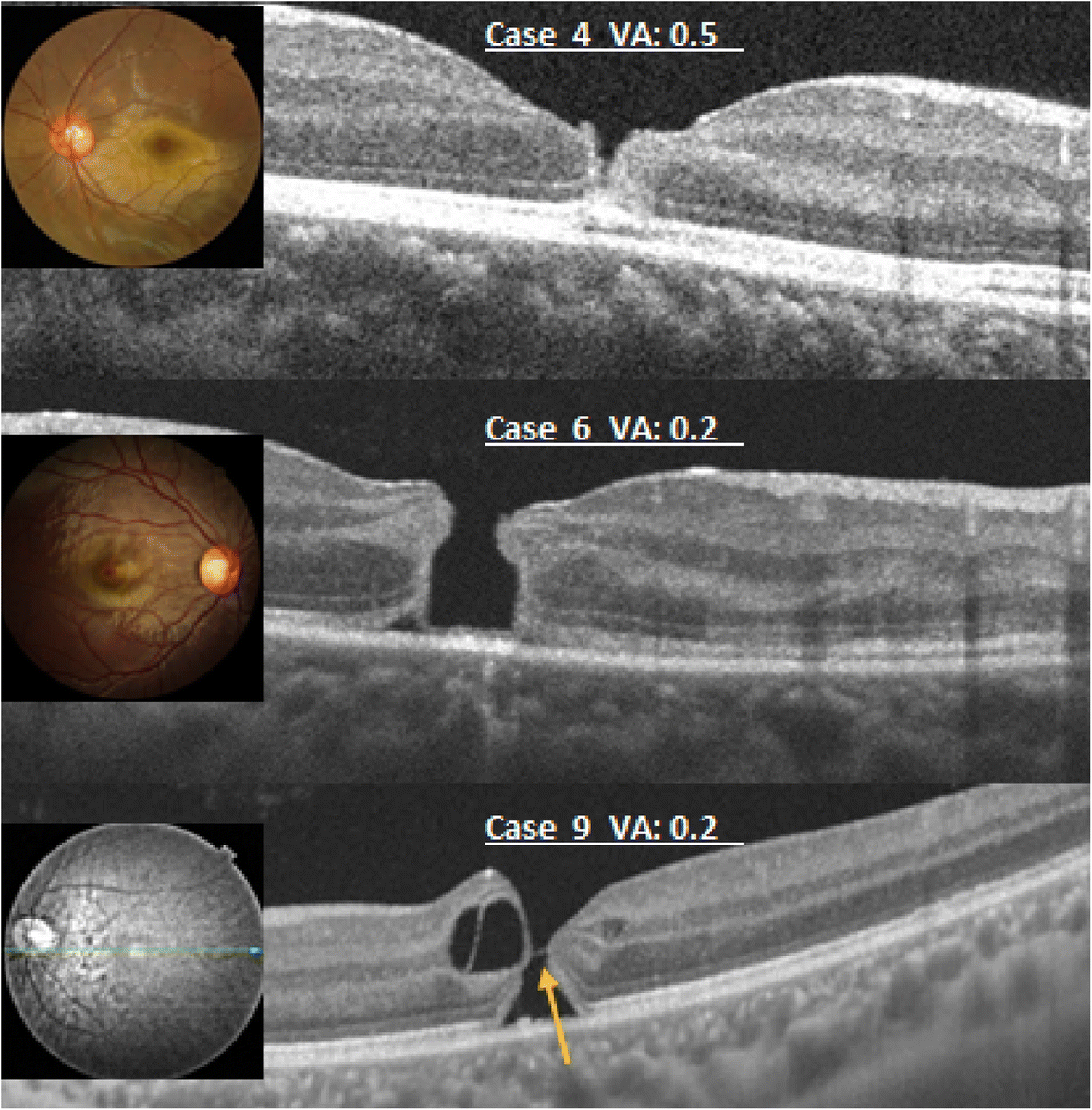 Fig. 3