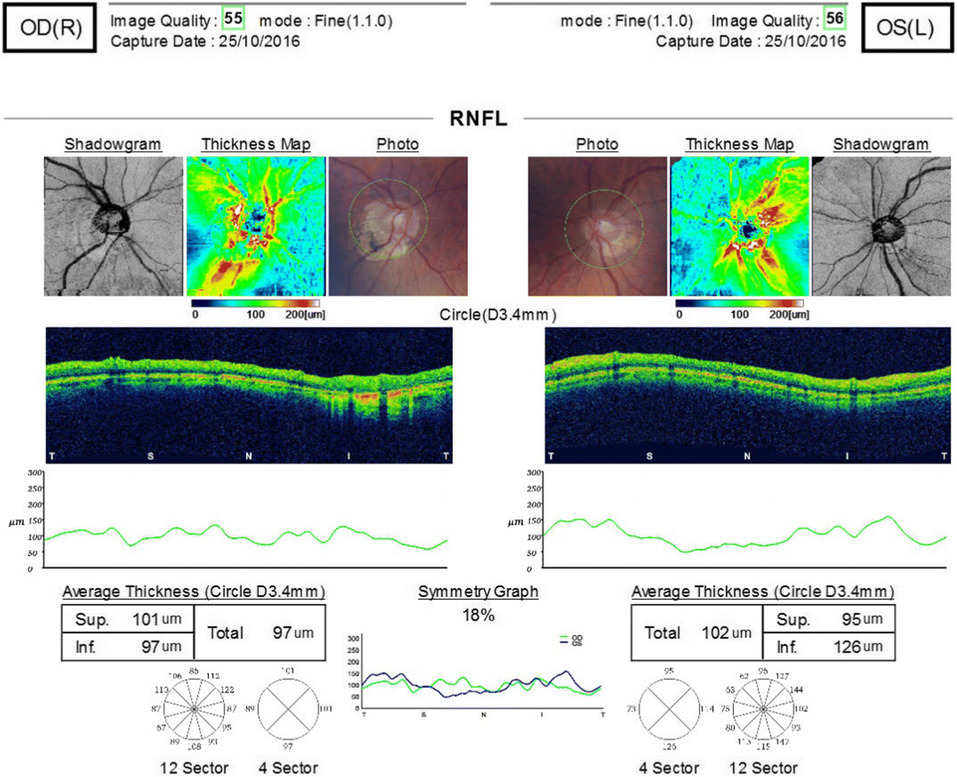 Fig. 2