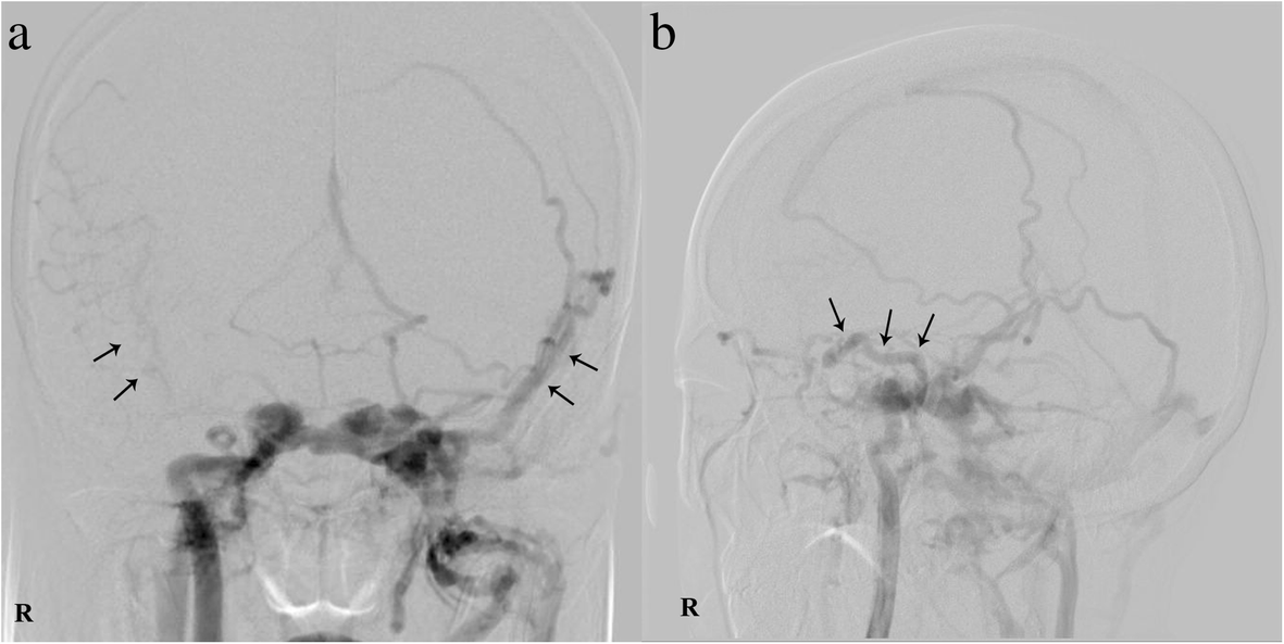 Fig. 5