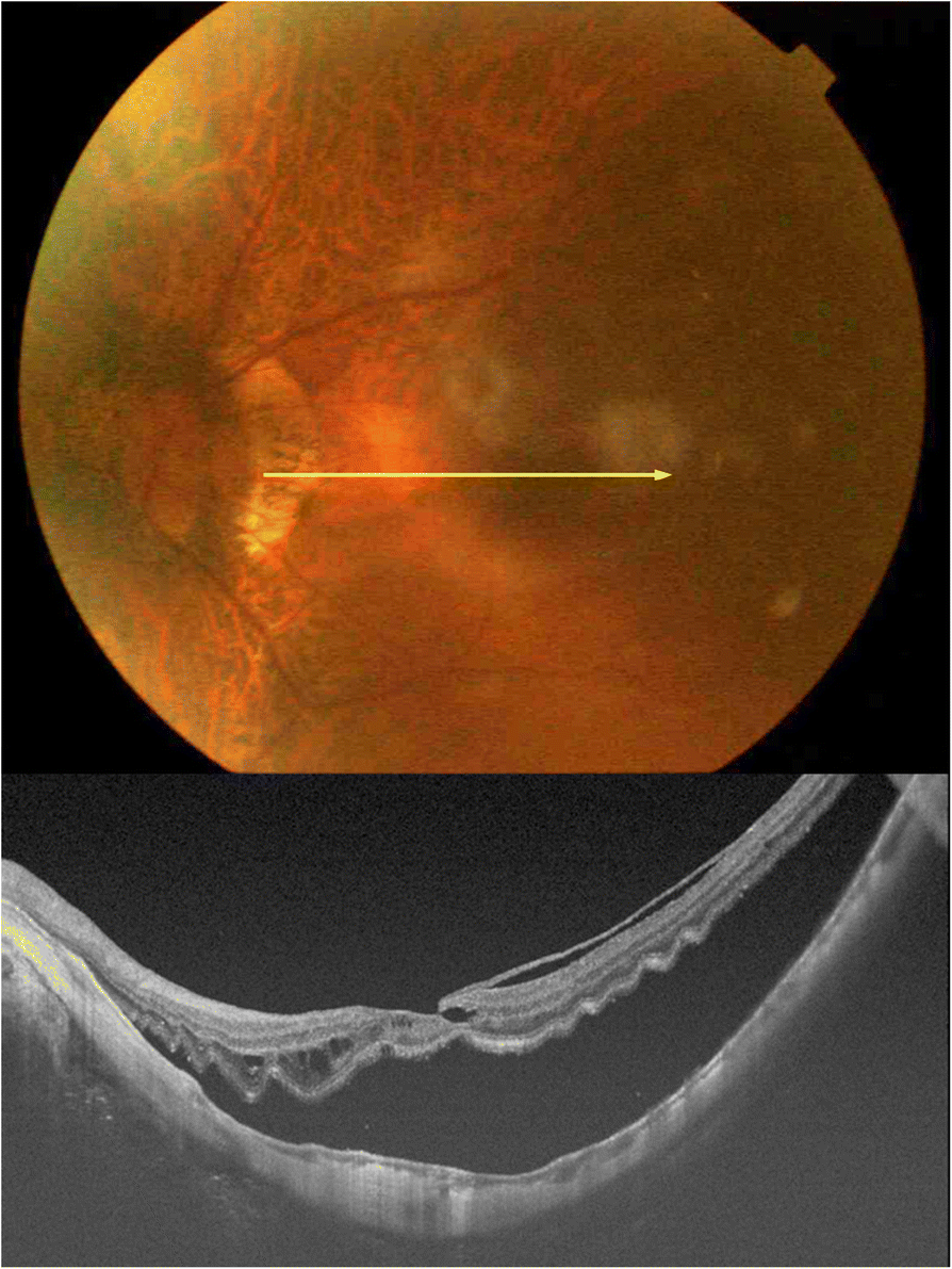 Fig. 1