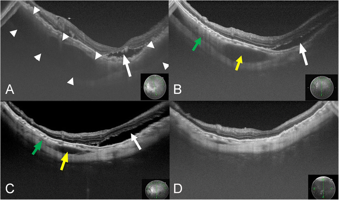 Fig. 3