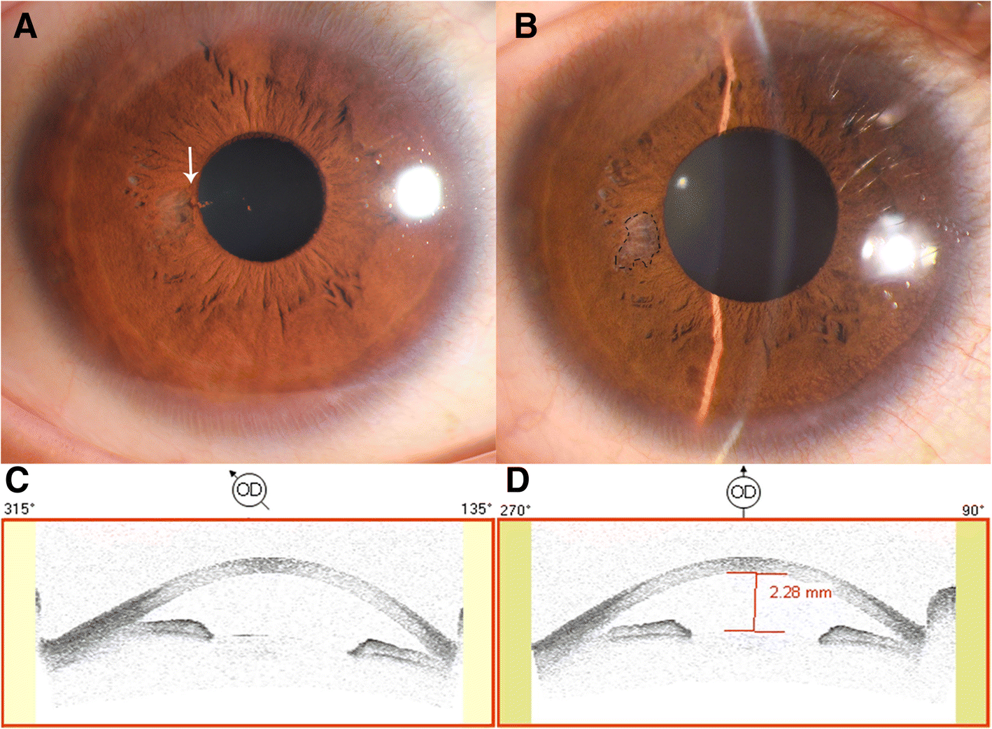 Eye search. Eye search