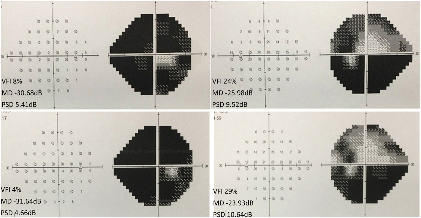 Fig. 2