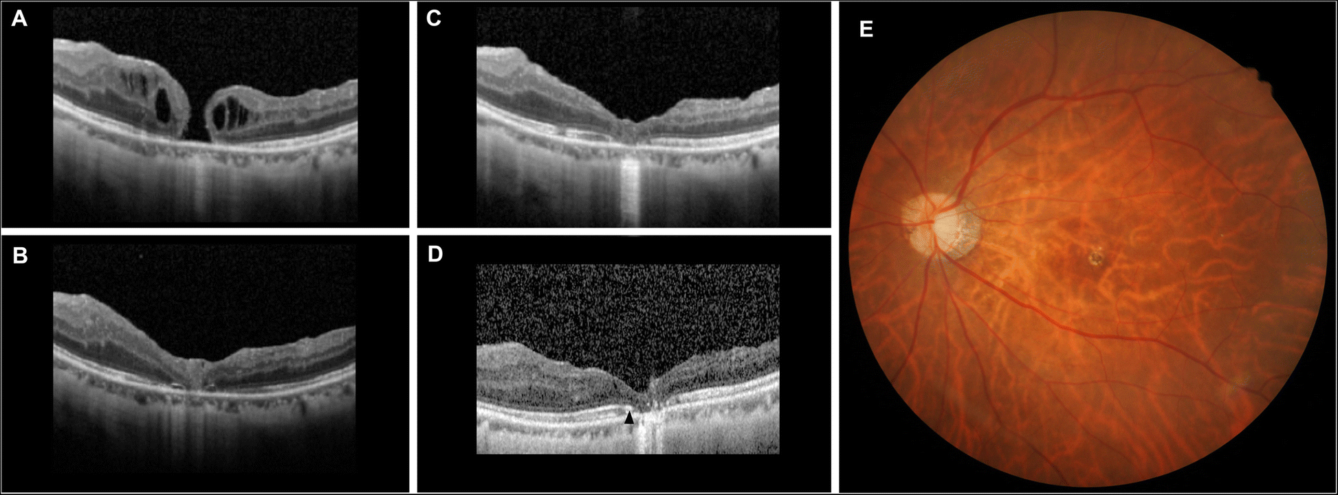 Fig. 2