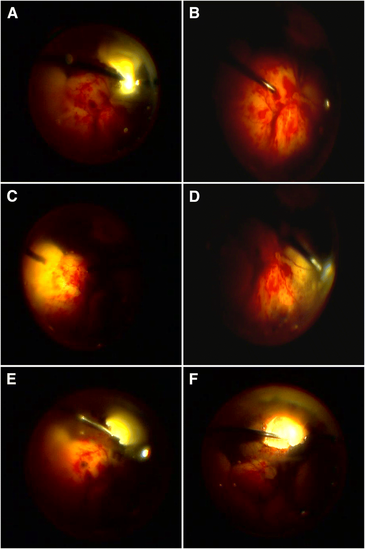 Fig. 3