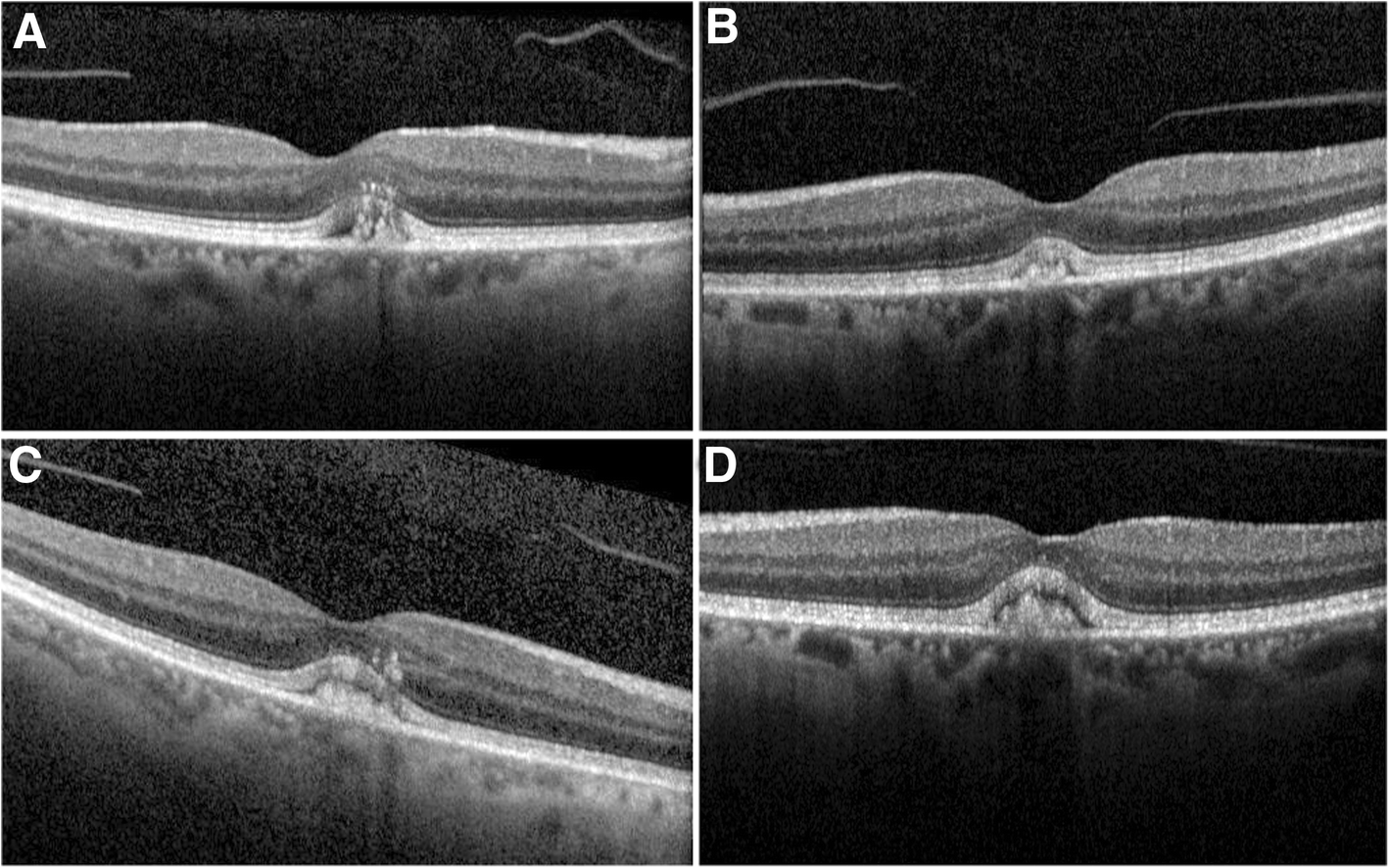 Fig. 2