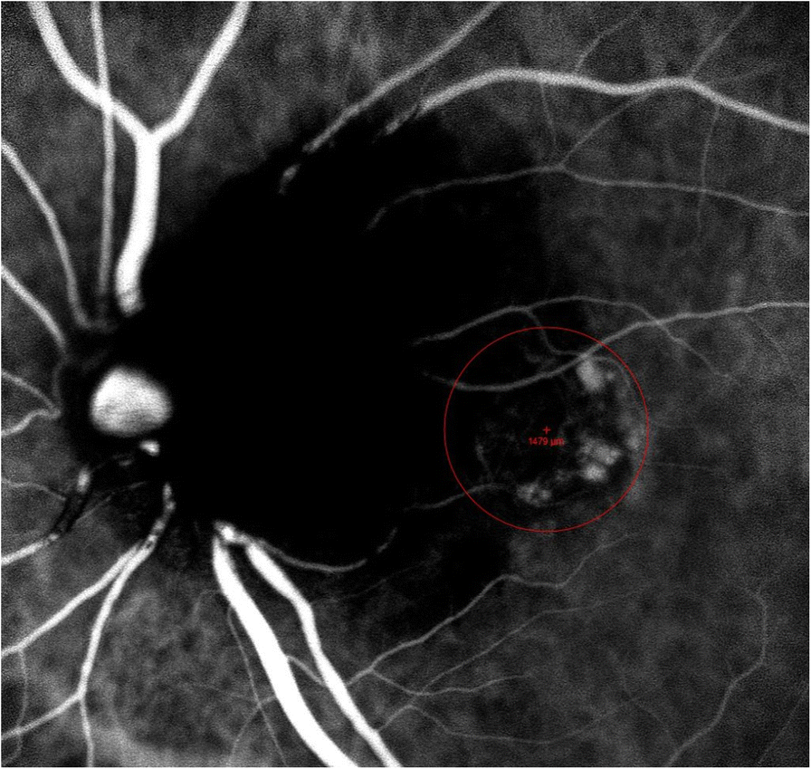 Fig. 4