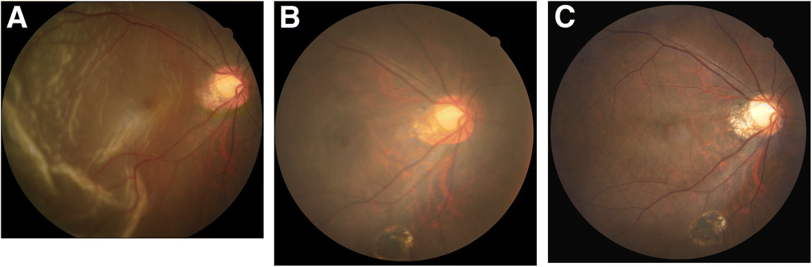 Fig. 1