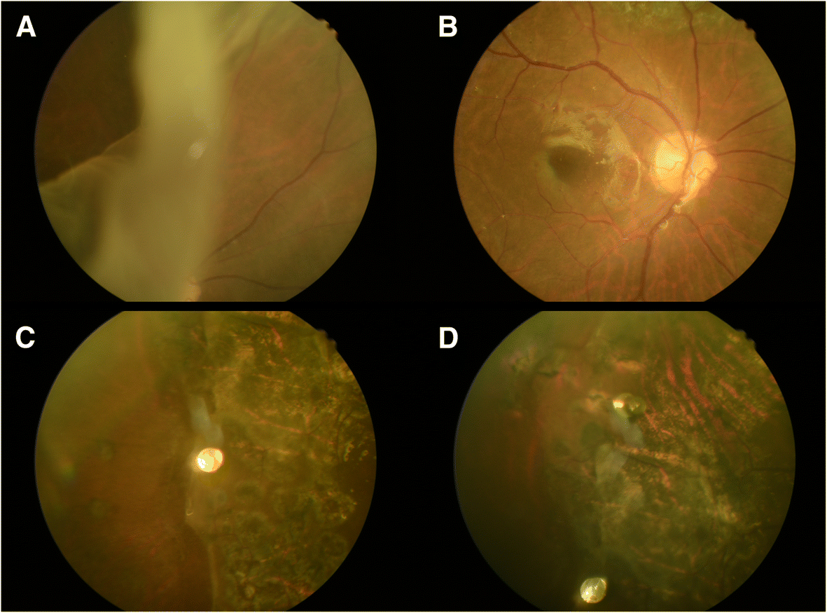 Fig. 1