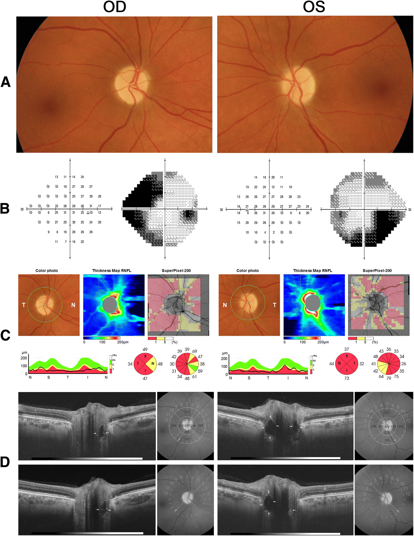 Fig. 1