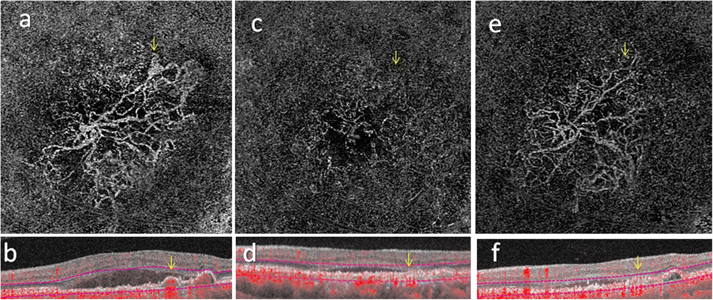 Fig. 4