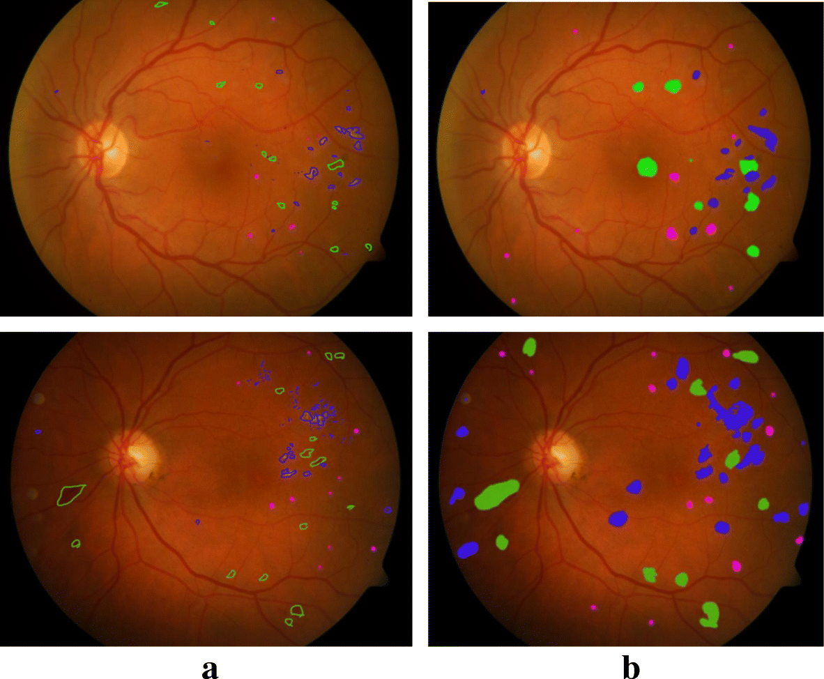 Fig. 12