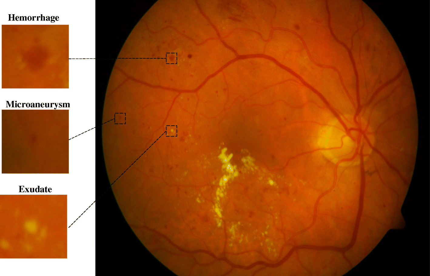 Fig. 1