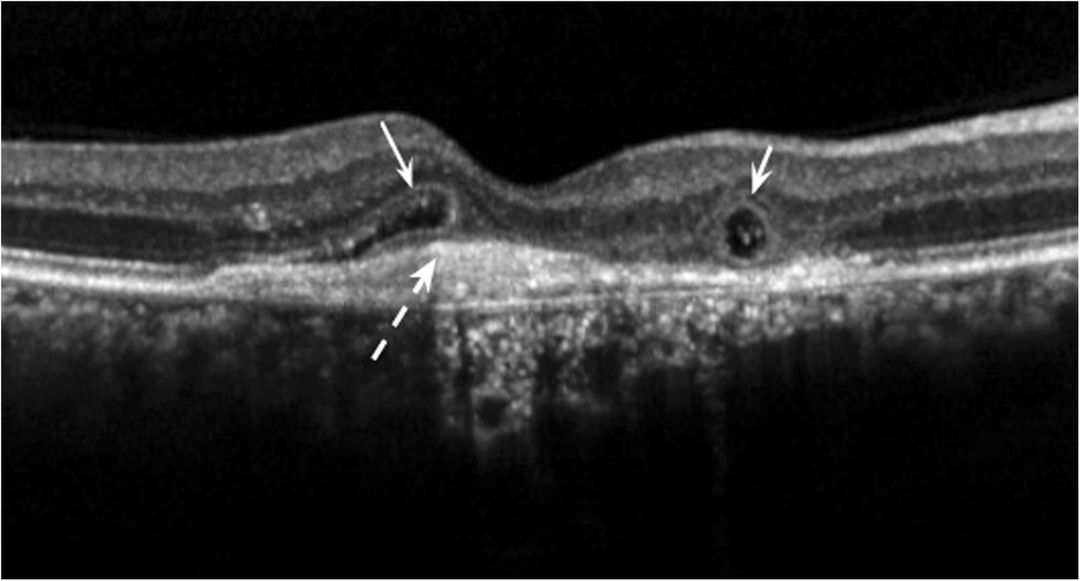 Fig. 1