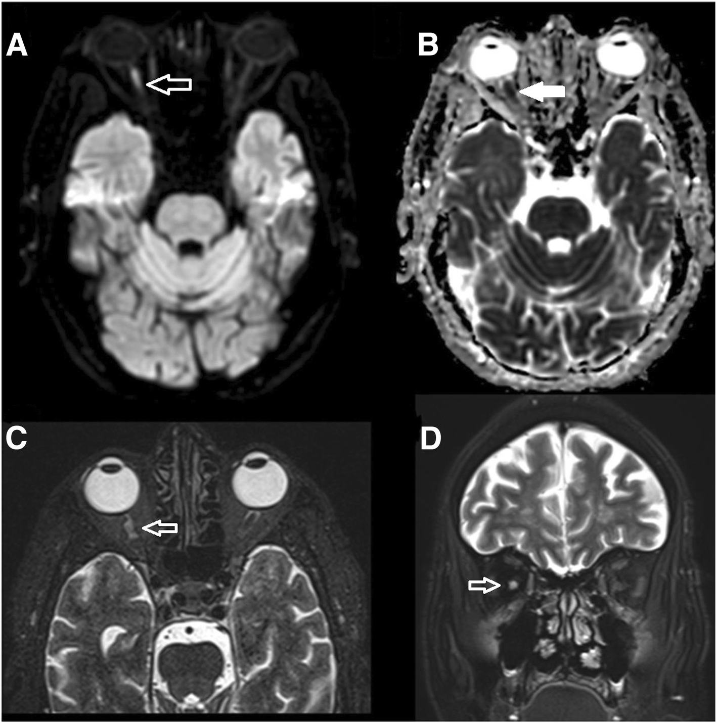 Fig. 1