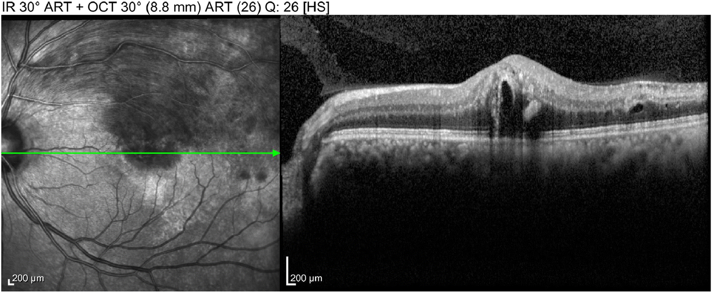 Fig. 2