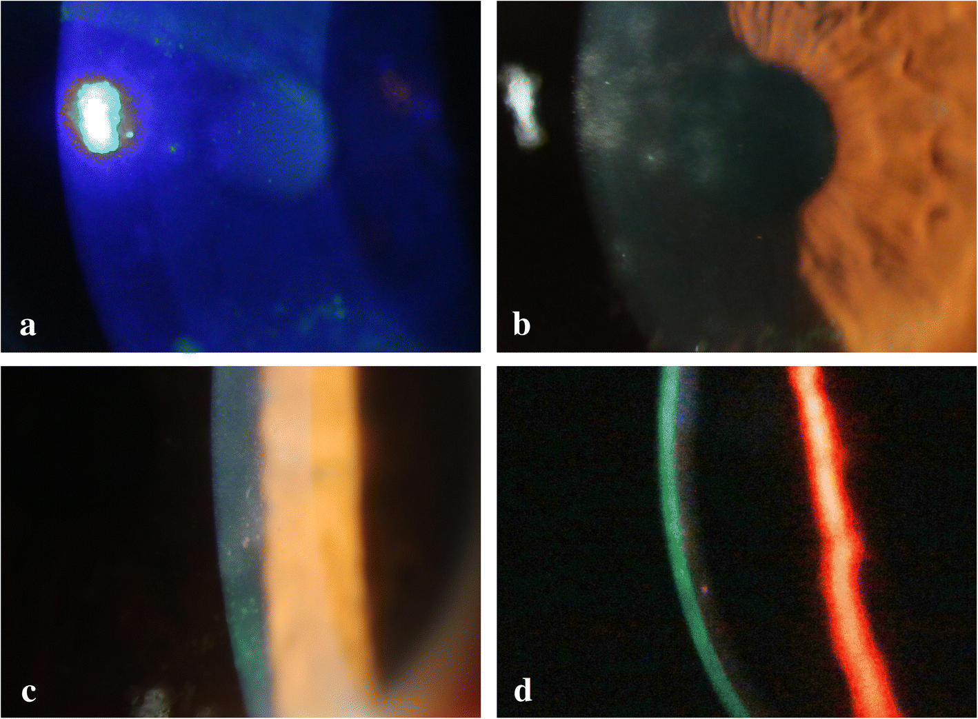 Fig 2