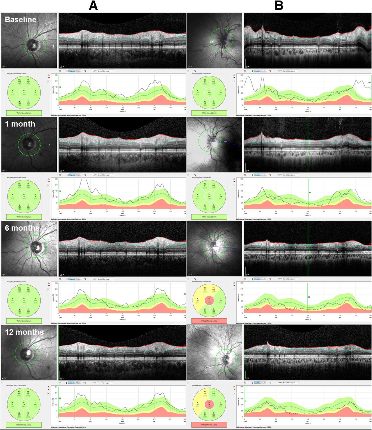 Fig. 4