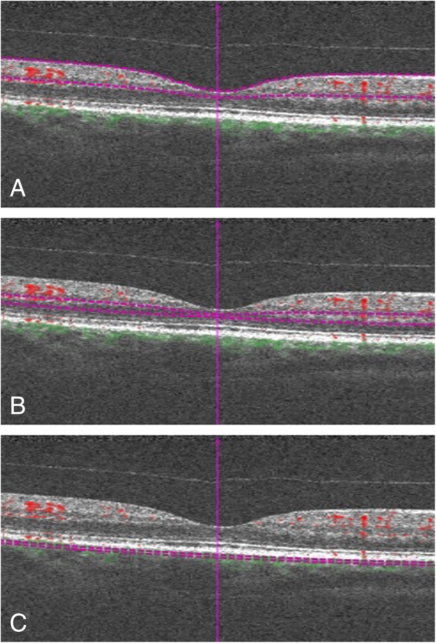 Fig. 1