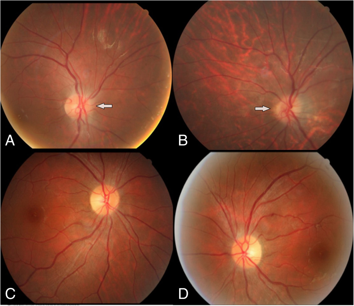 Fig. 1