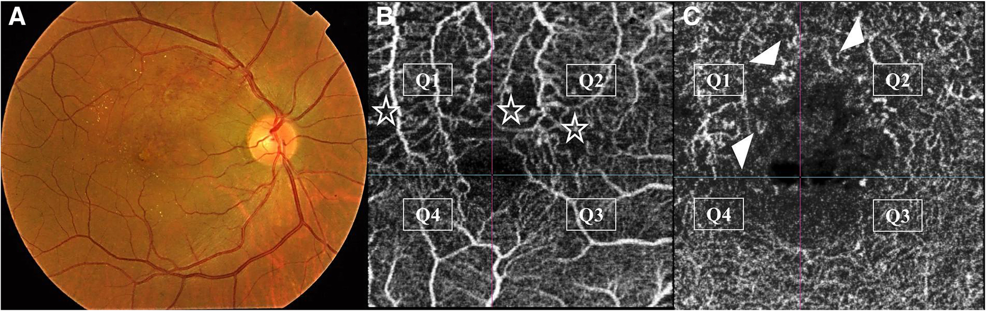 Fig. 3