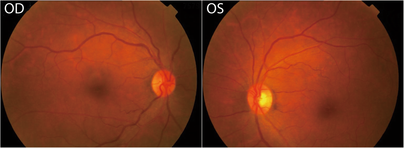 Fig. 1