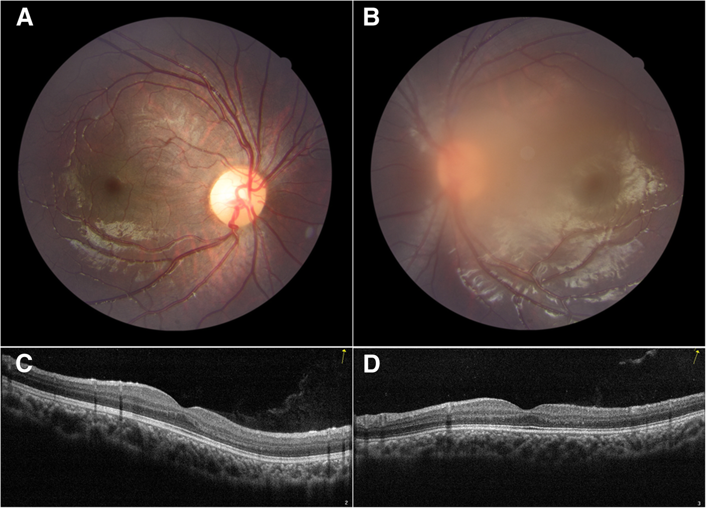 Fig. 2