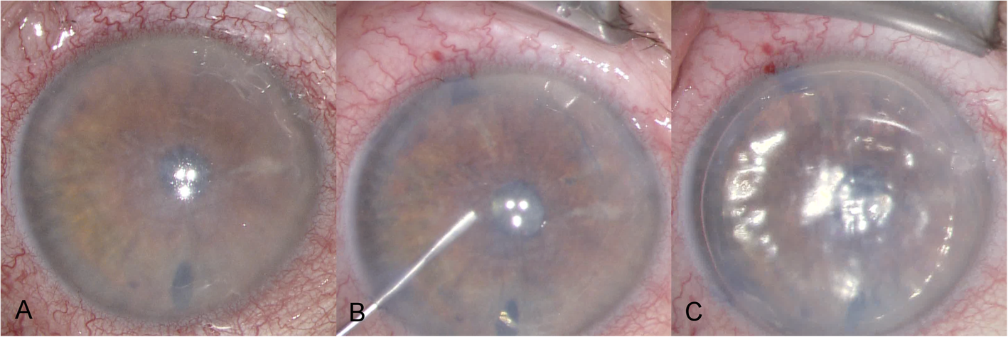 Fig. 2