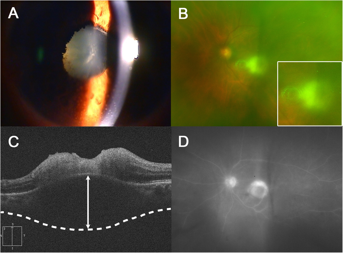 Fig. 1