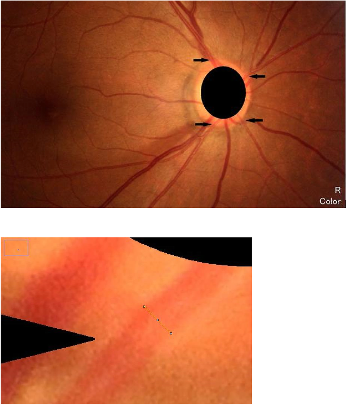 Fig. 1