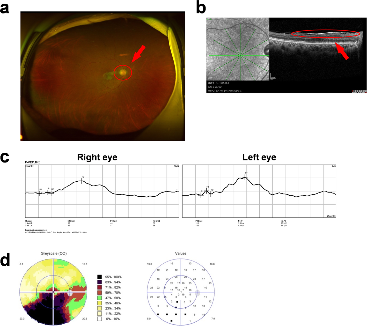 Fig. 4