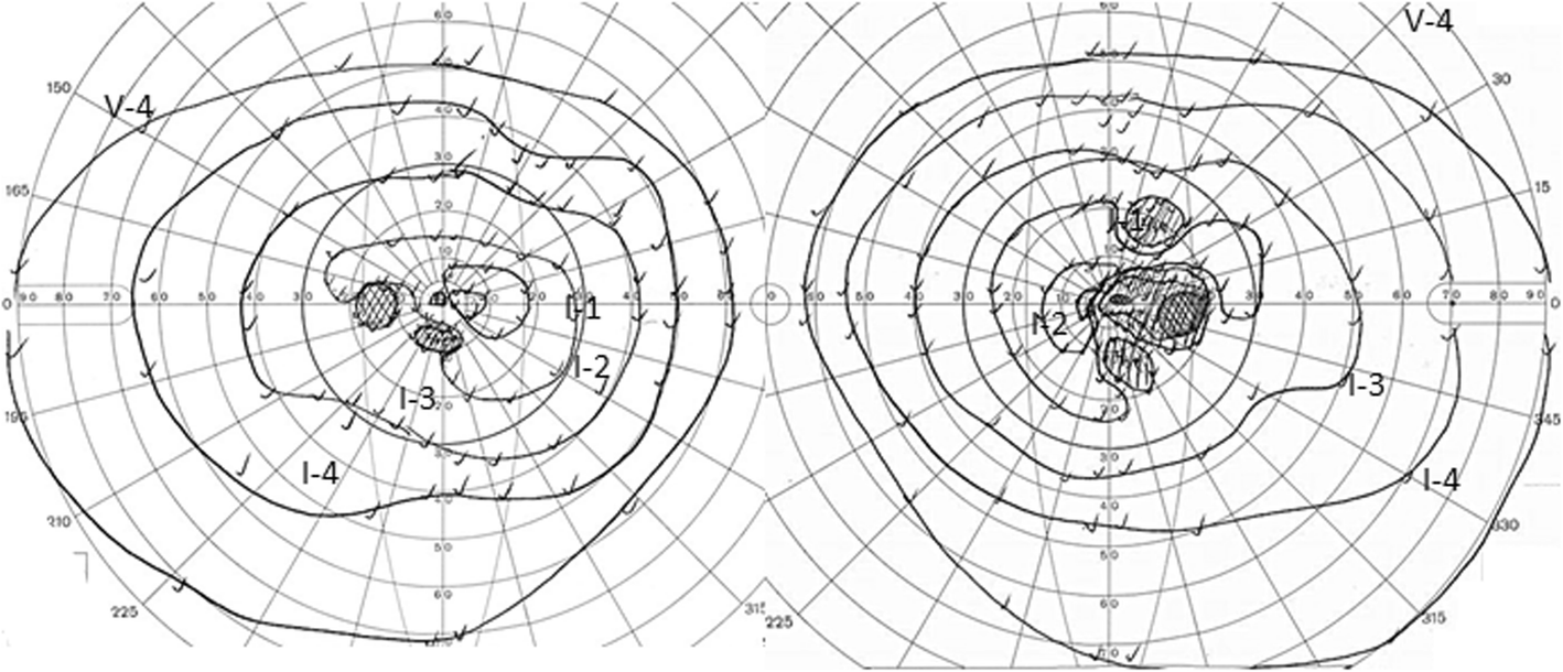 Fig. 1