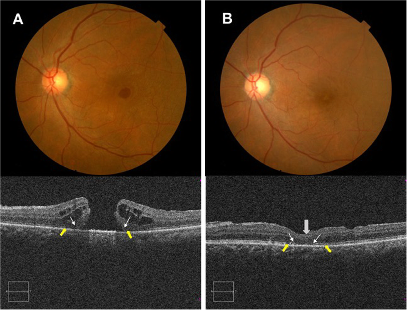 Fig. 3