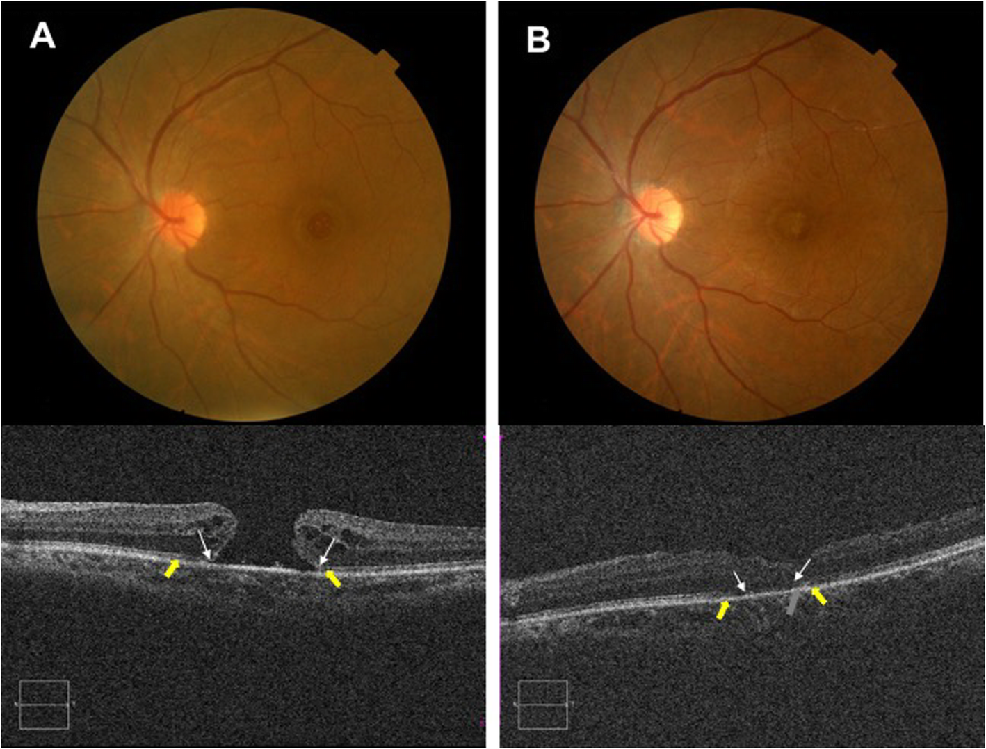 Fig. 4