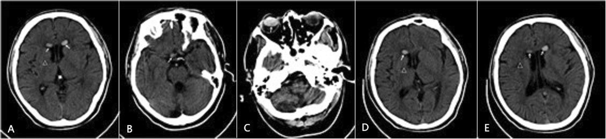 Fig. 1