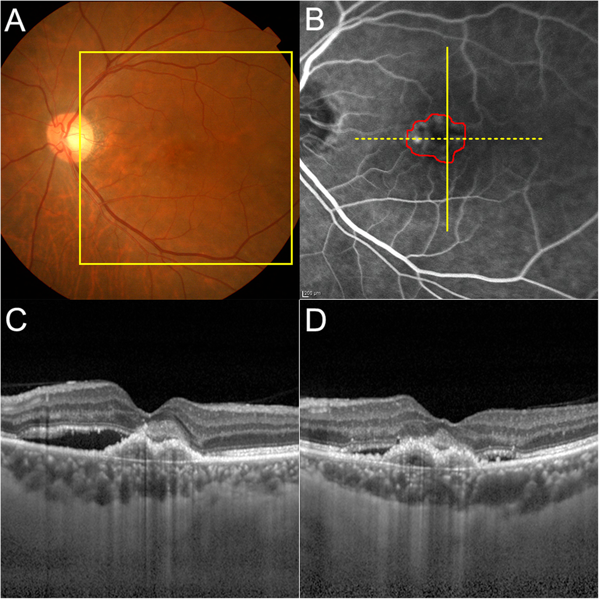 Fig. 2