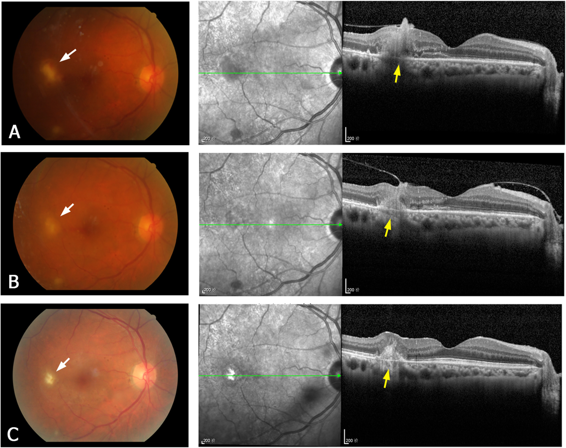 Fig. 1