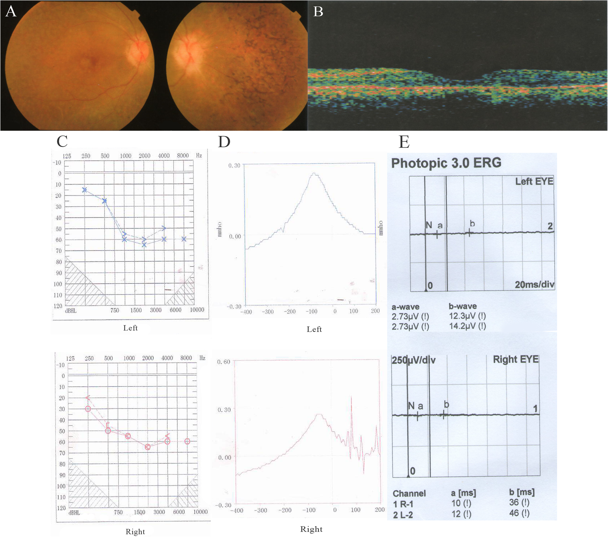 Fig. 1