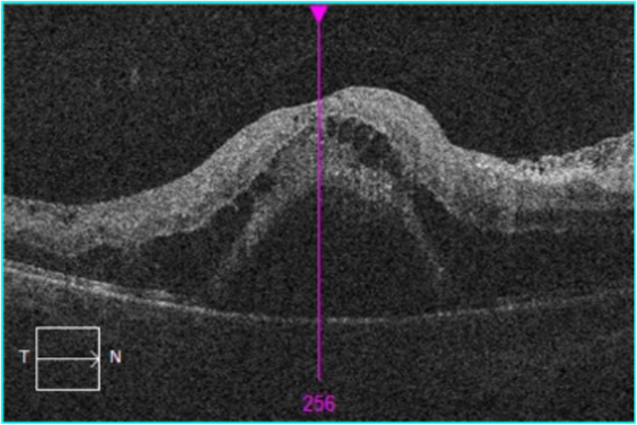 Fig. 2