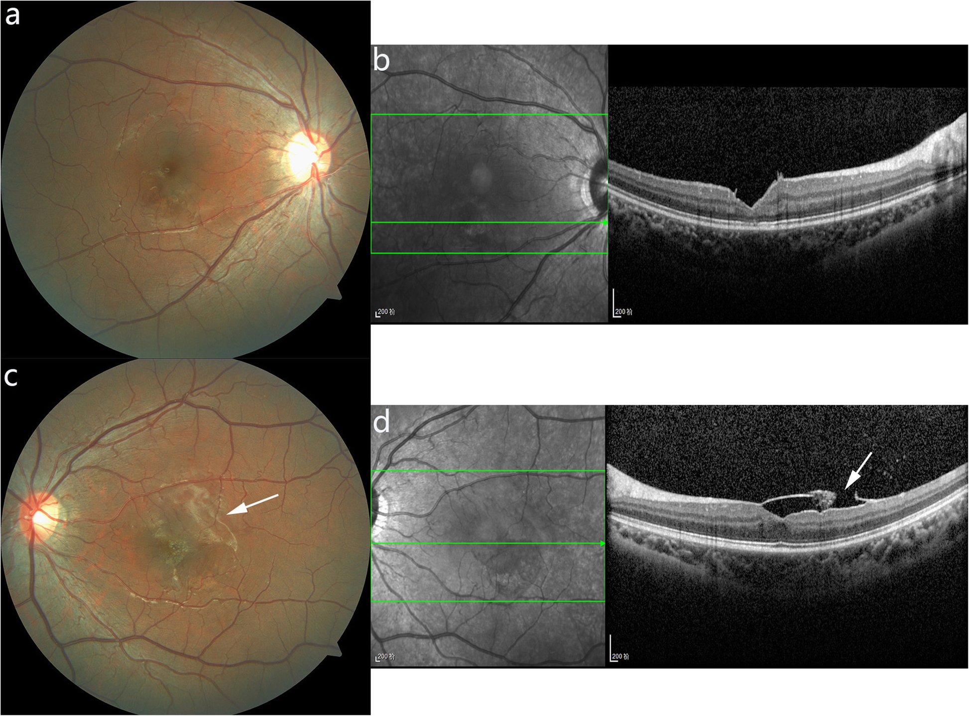 Fig. 3