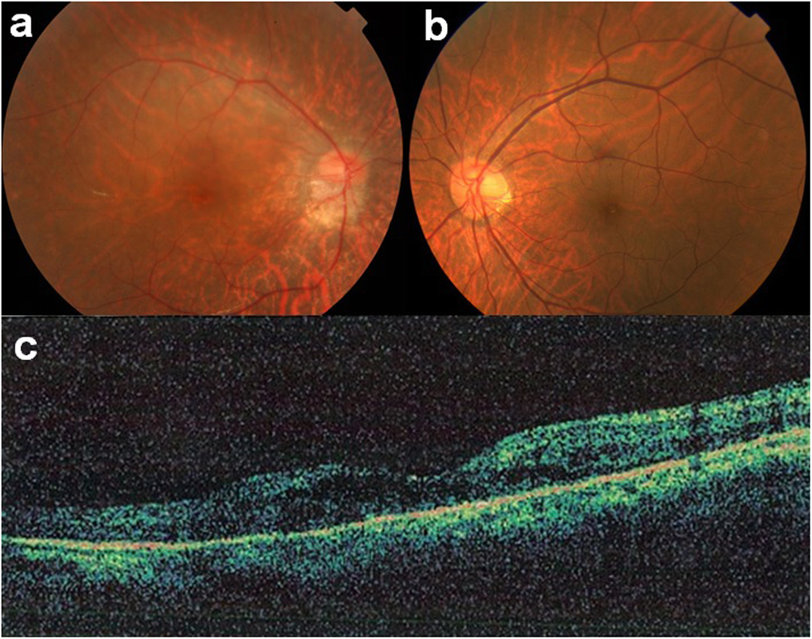 Fig. 1