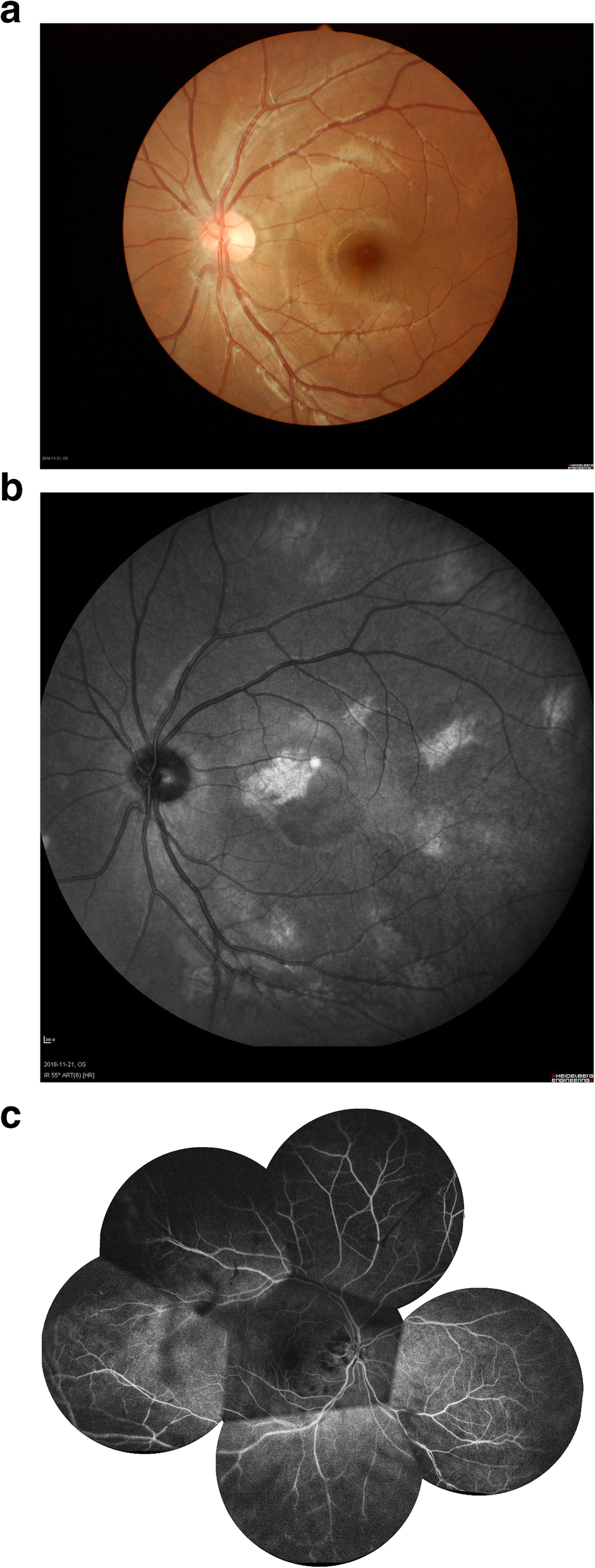 Fig. 2