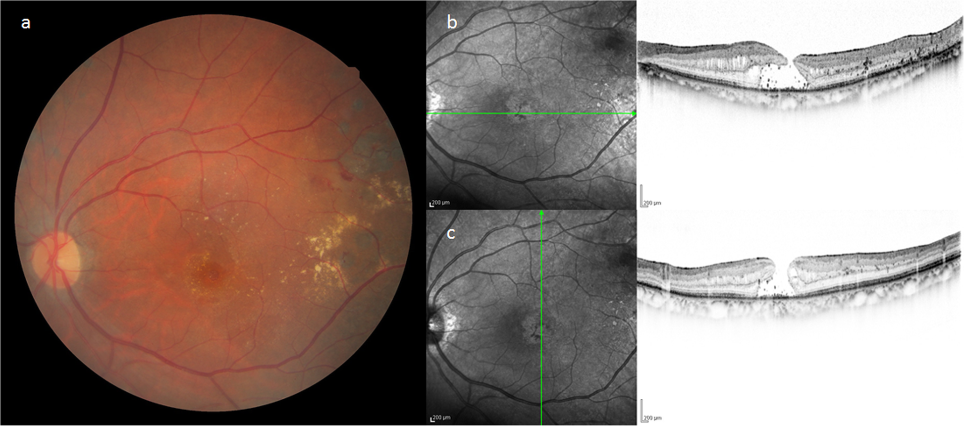 Fig. 2