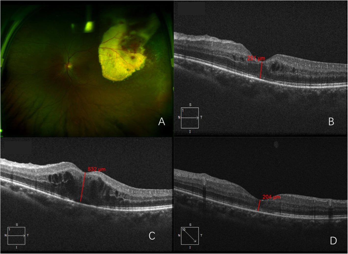 Fig. 2