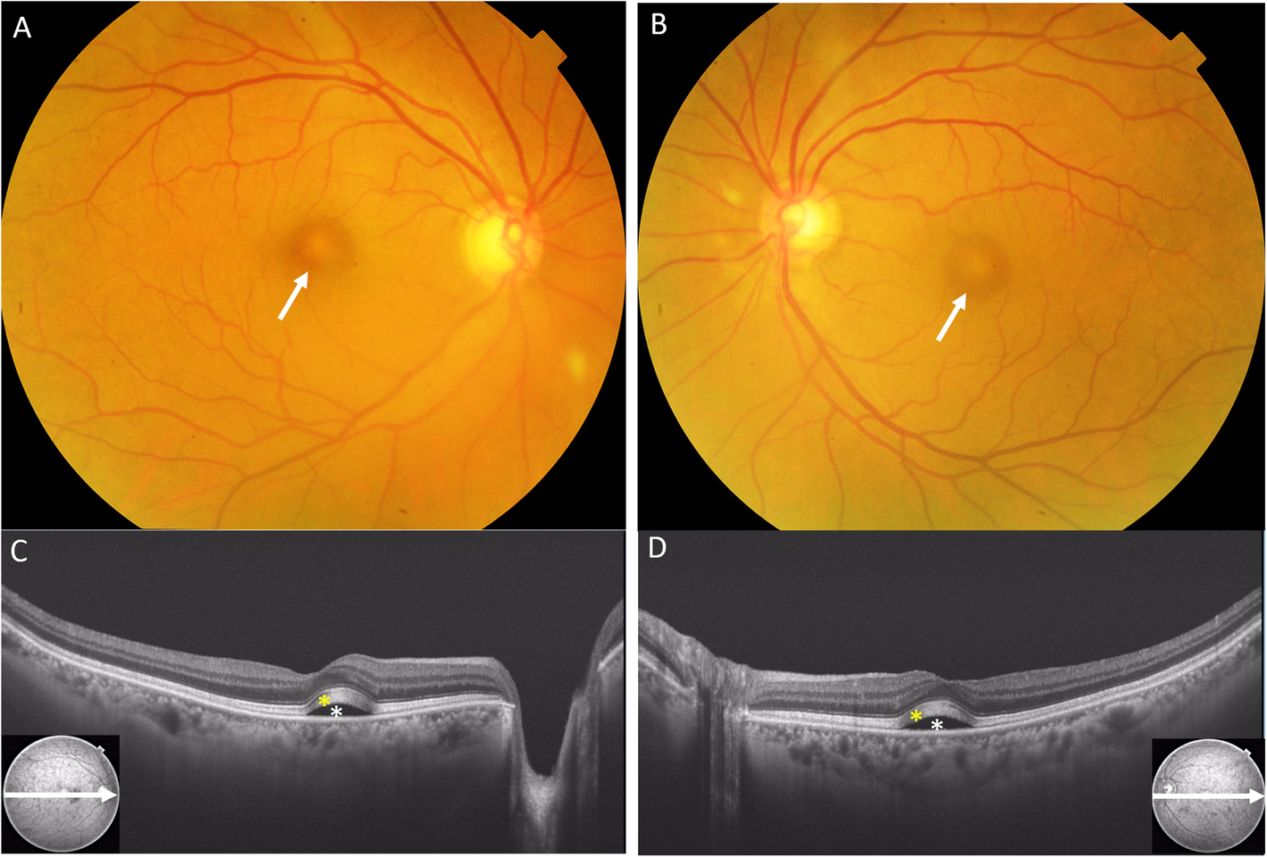 Fig. 1