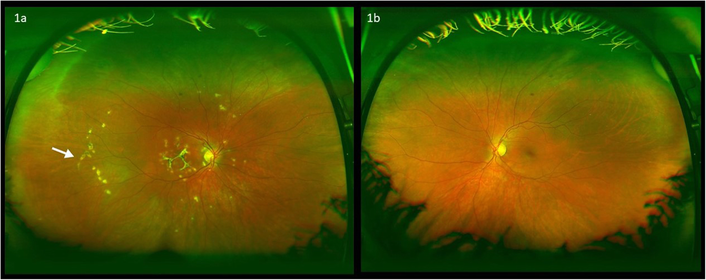 Fig. 1