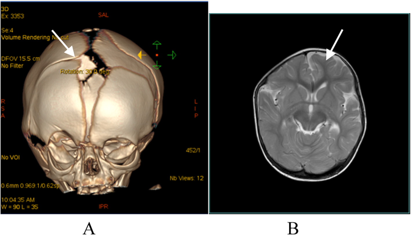 Fig. 6