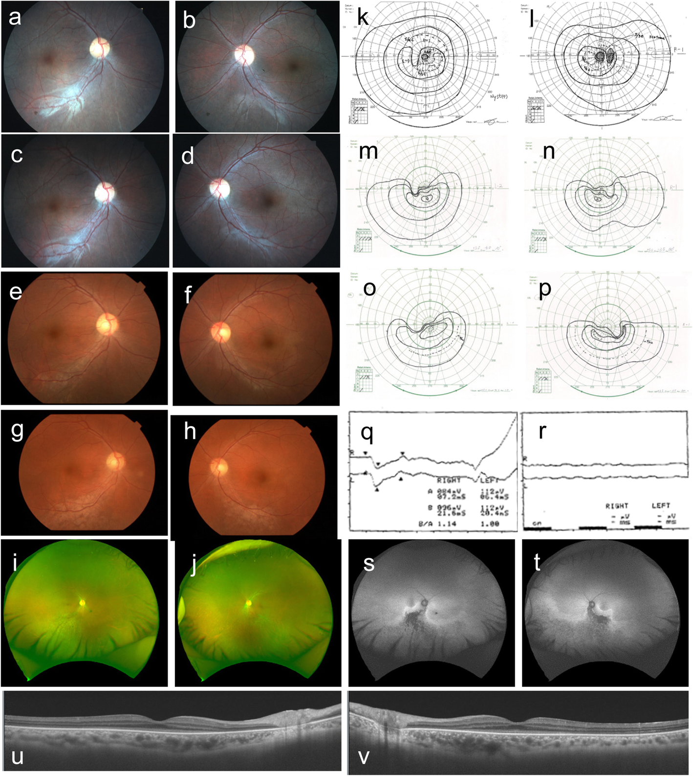 Fig. 1