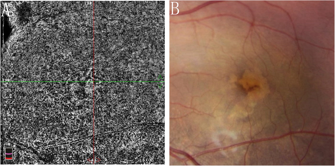 Fig. 6